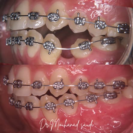 Orthodontics 1