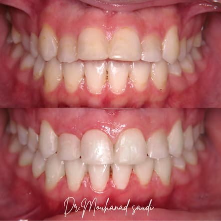 Orthodontics 2