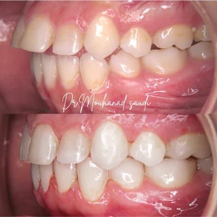 Orthodontics 3