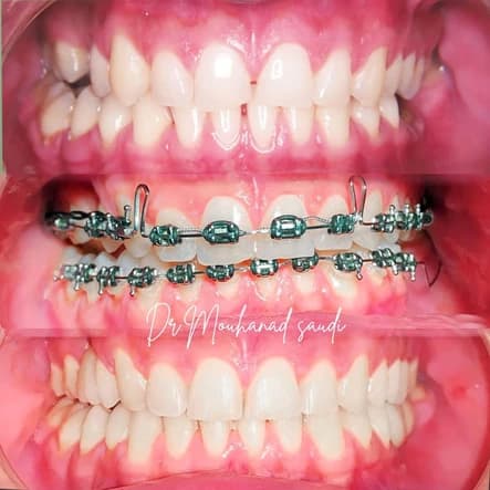 Orthodontics 7