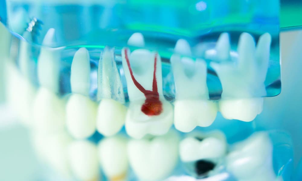 Endodontics